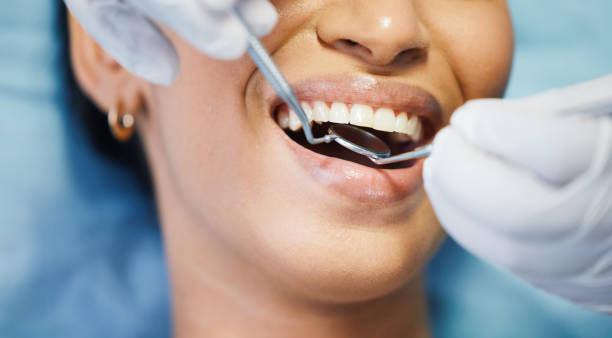 Best Same-Day Emergency Dental Services in Fort Mckinley, OH