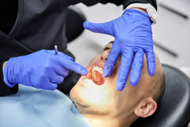 Best Same-Day Emergency Dental Services in Fort Mckinley, OH